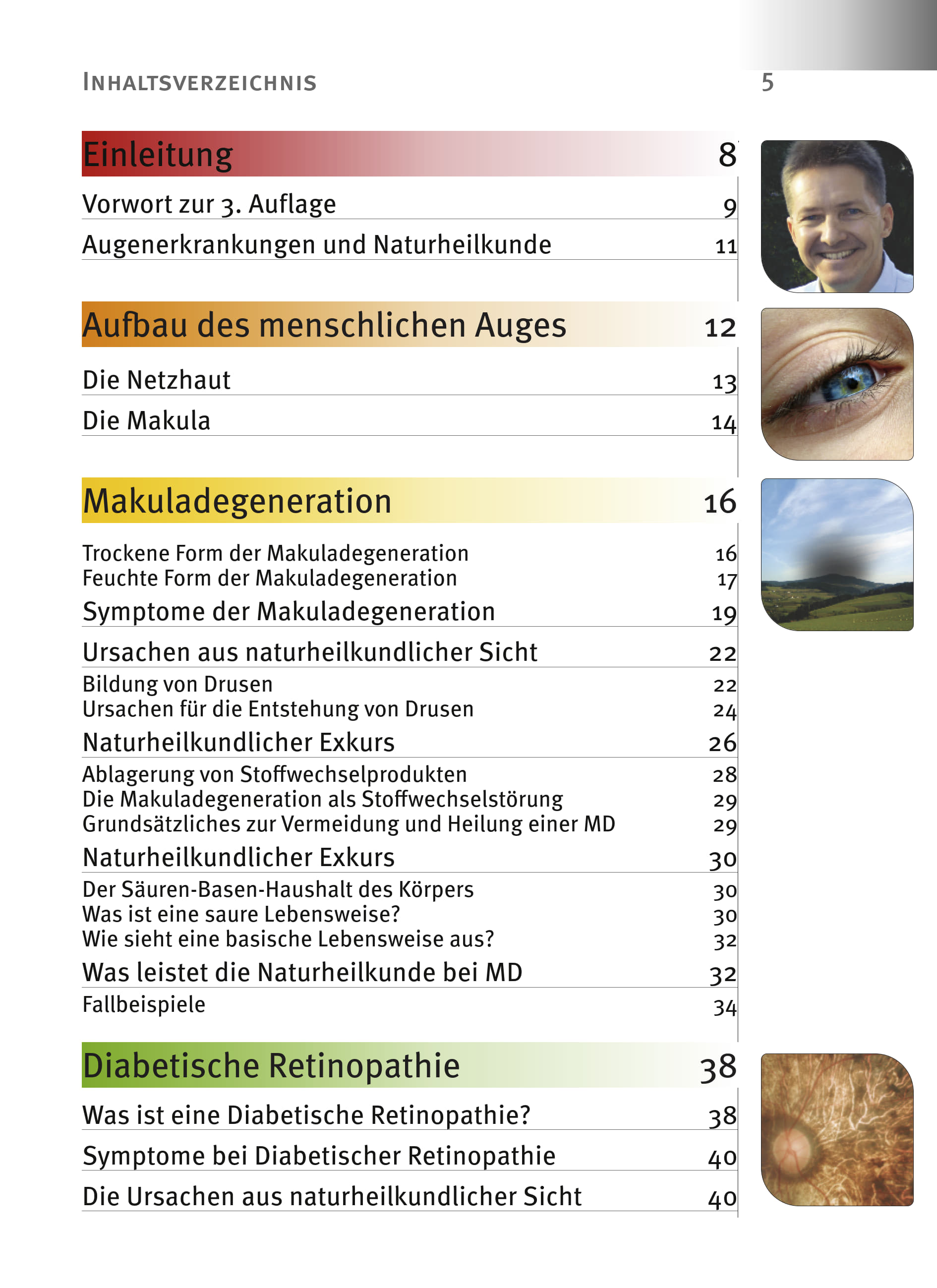 Auszug Inhaltsverzeichnis: Makuladegeneration, Diabetische Retinopathie